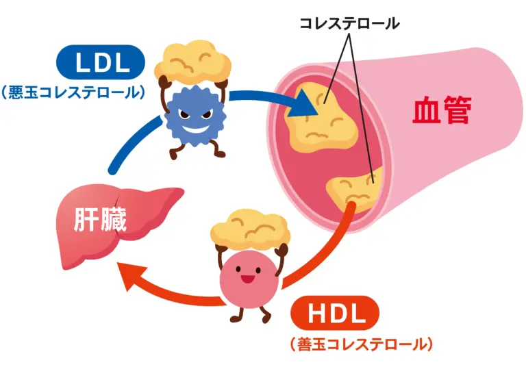 イラスト：LDLとHDLの仕組み-脂質異常症-血管-コレステロール